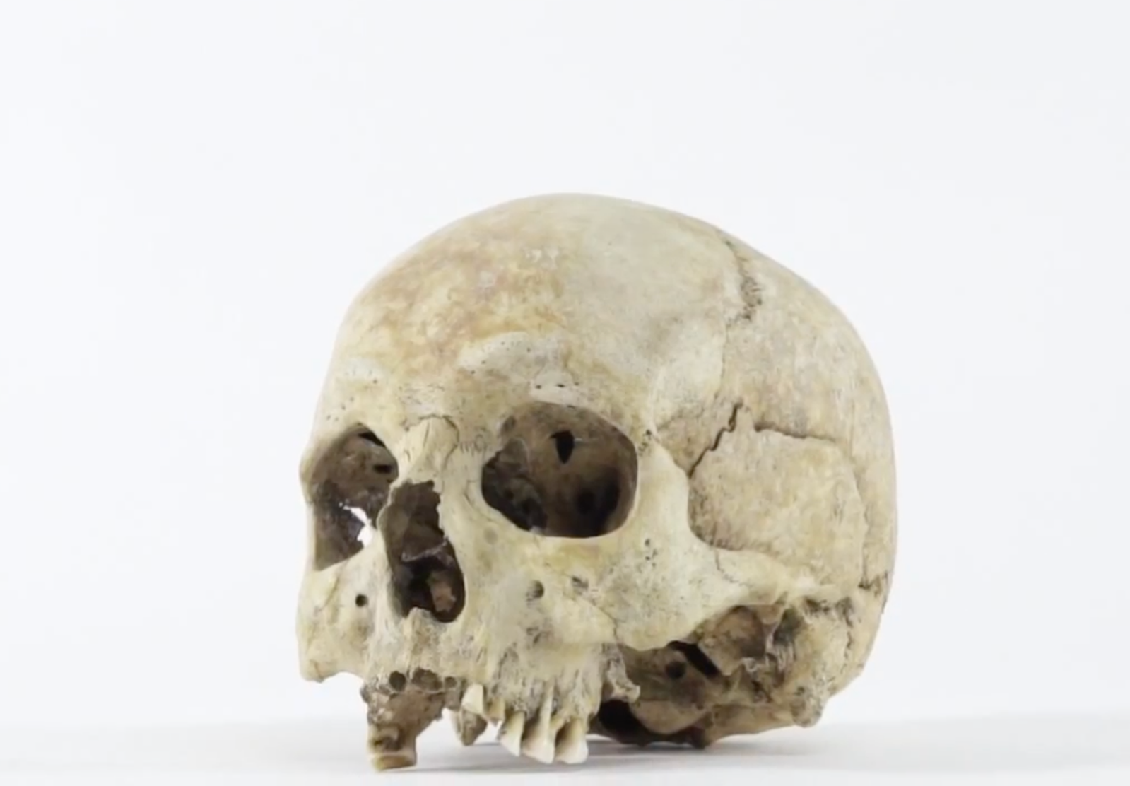 The skull — an image from the project.
